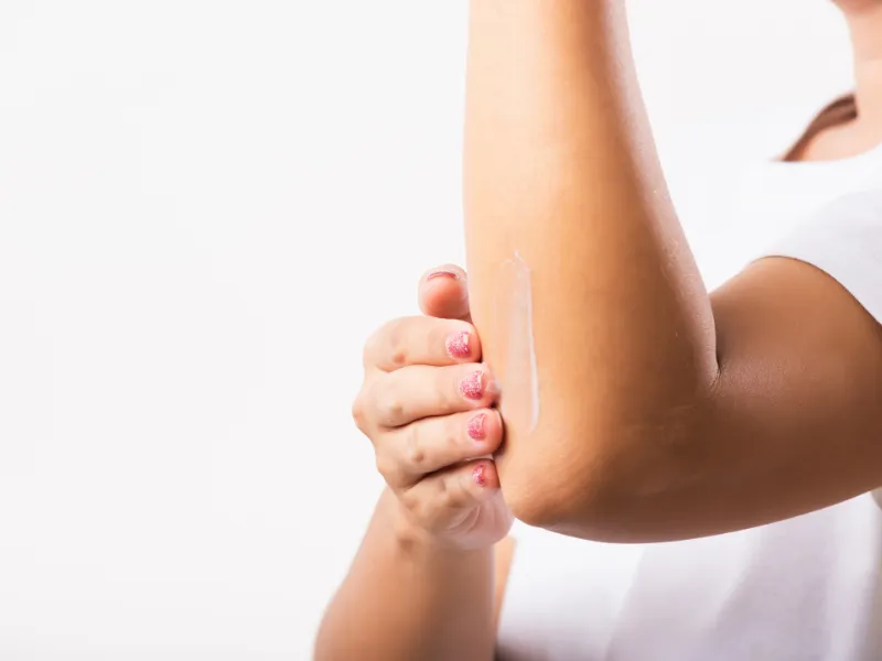 elbow brightening candidates
