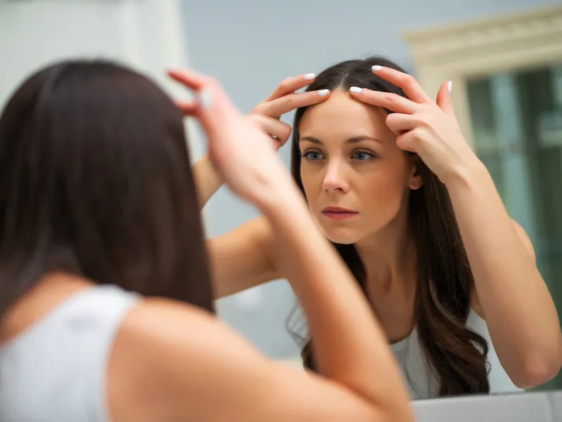 forehead smoothing results